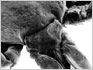 Tick Mouthparts