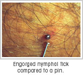 Lyme Disease - Introduction to Symptoms, Diagnosis and Treatment