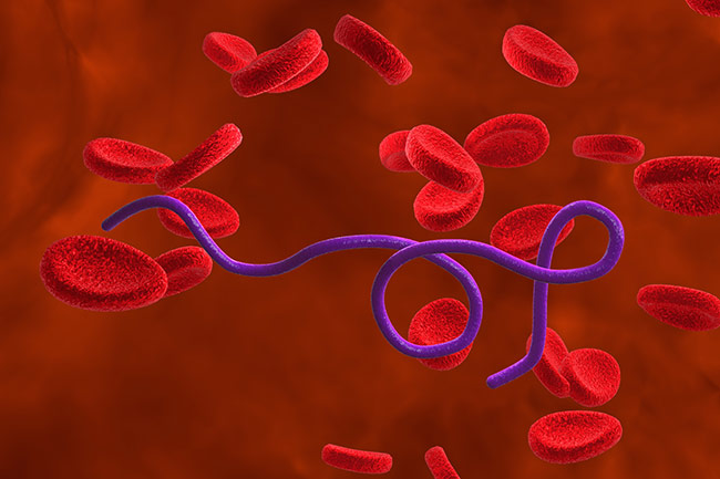 Borrelia Symptom Patterns