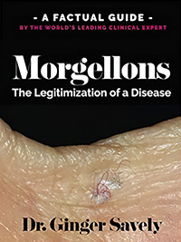 Morgellons: The Legitimization of a Disease