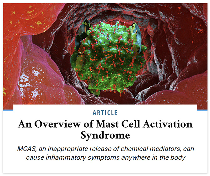 An Overview of Mast Cell Activation Syndrome