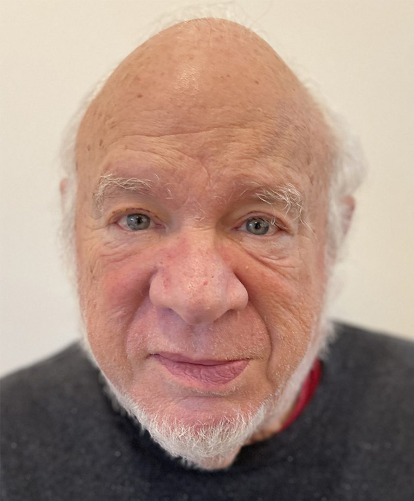 Lowell Miller battling Lyme disease