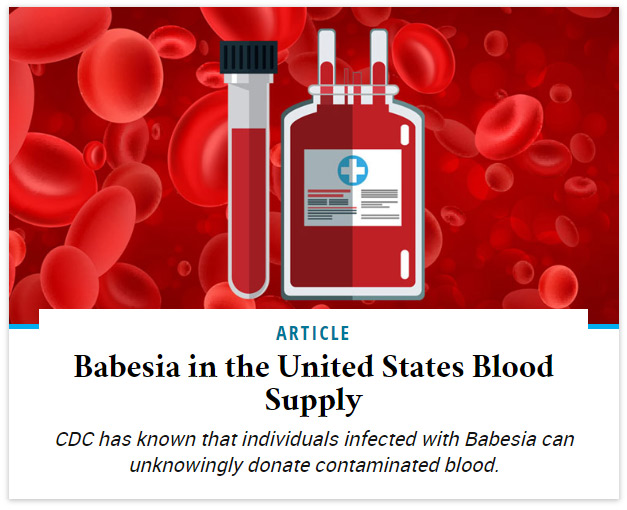 Babesia in the United States Blood Supply