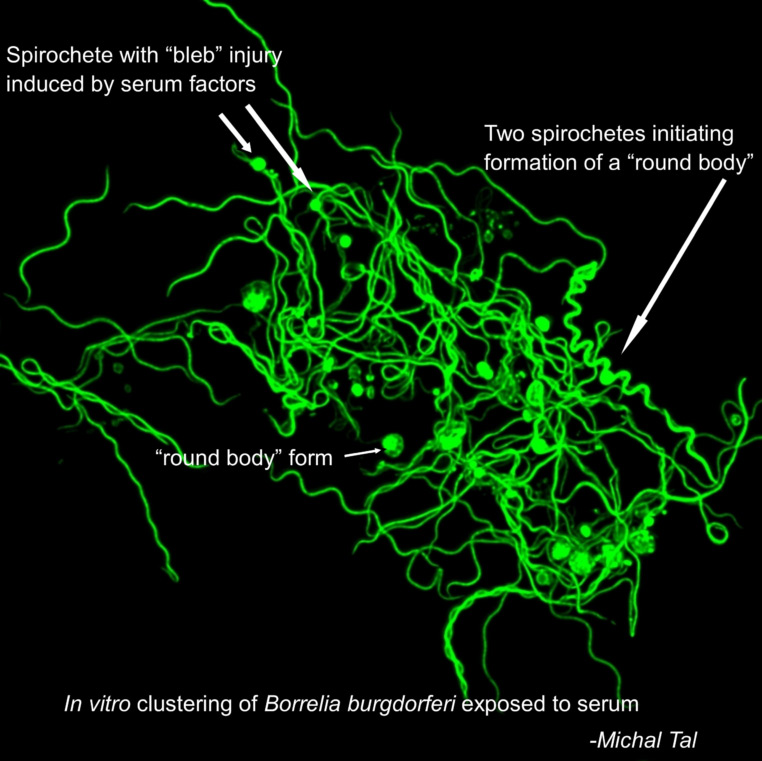 Lyme bacteria form persisters killed by azlocillin