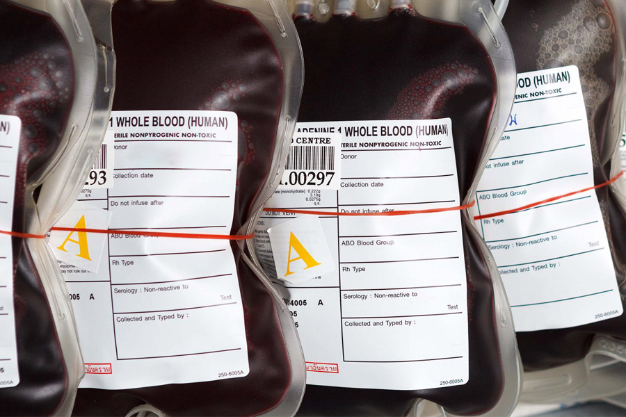 Babesia in the U.S. Blood Supply