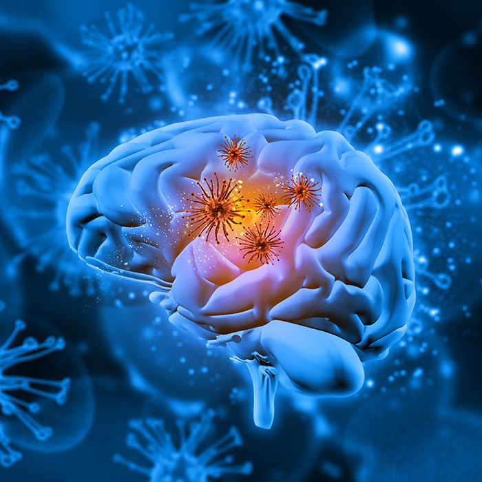 Brain inflammation triggers neuropsychiatric symptoms