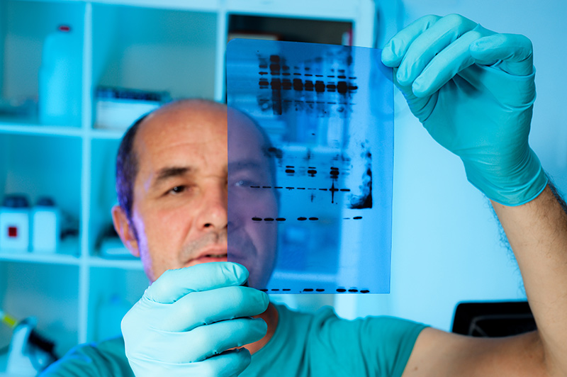 Western blot lyme test is performed to confirm the accuracy