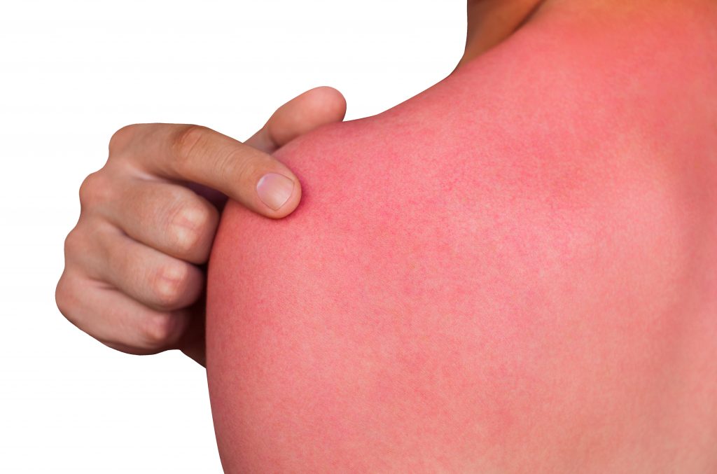 Lyme Disease less common symptoms - Allodynia