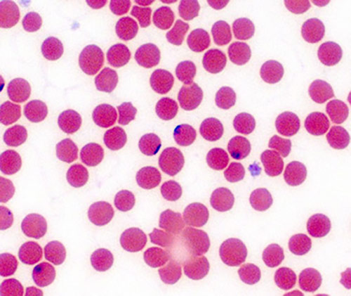 Babesia or Babesia-Like Organism (BABLO)