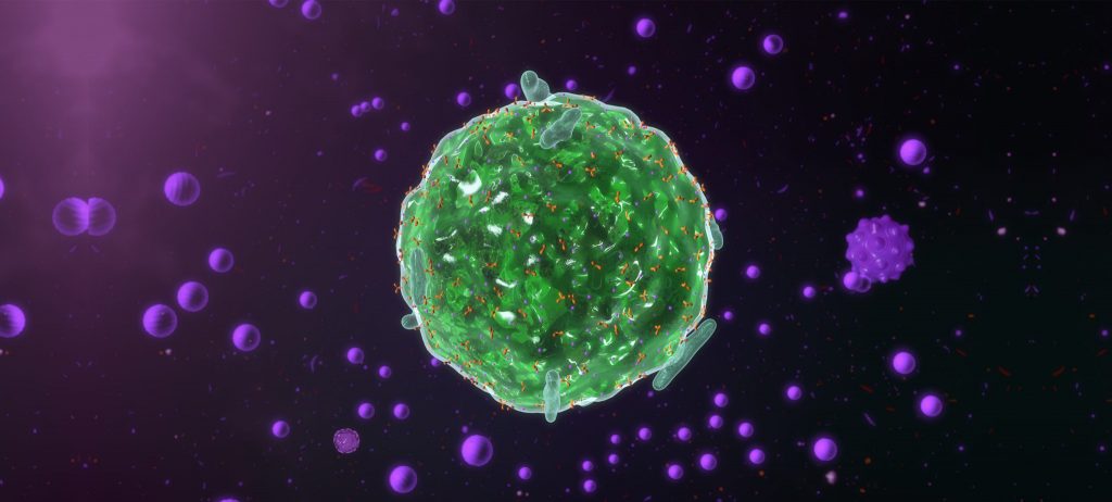 lyme patients can develop mast cell activation syndrome mcas survey practice