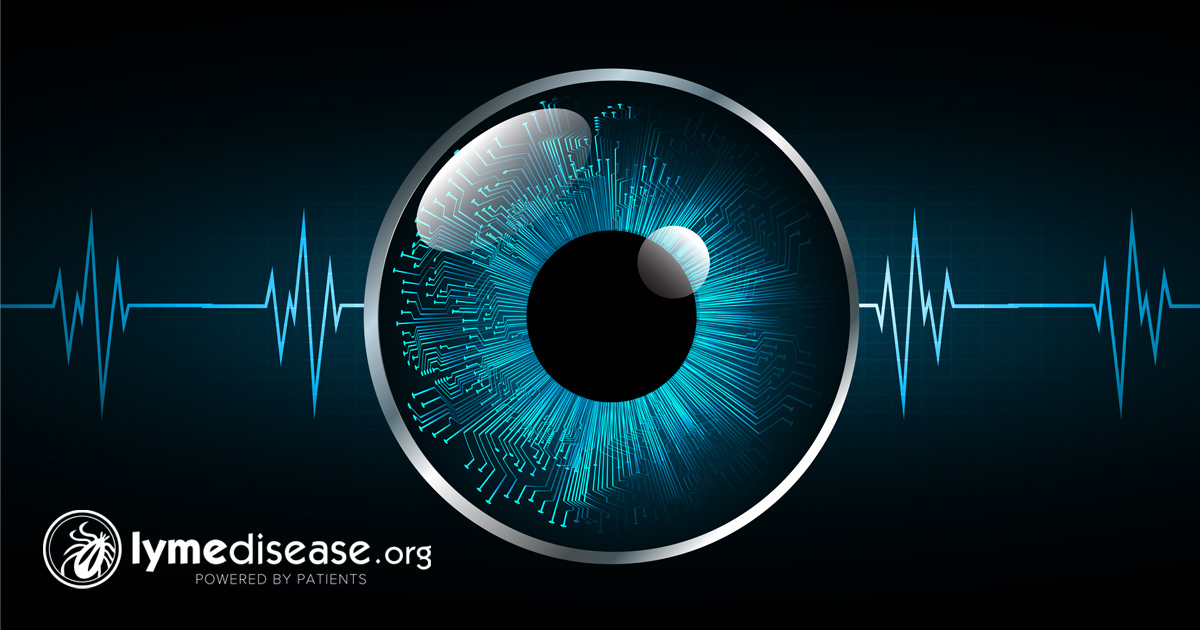 Rehabilitating Your LymeImpaired Vision