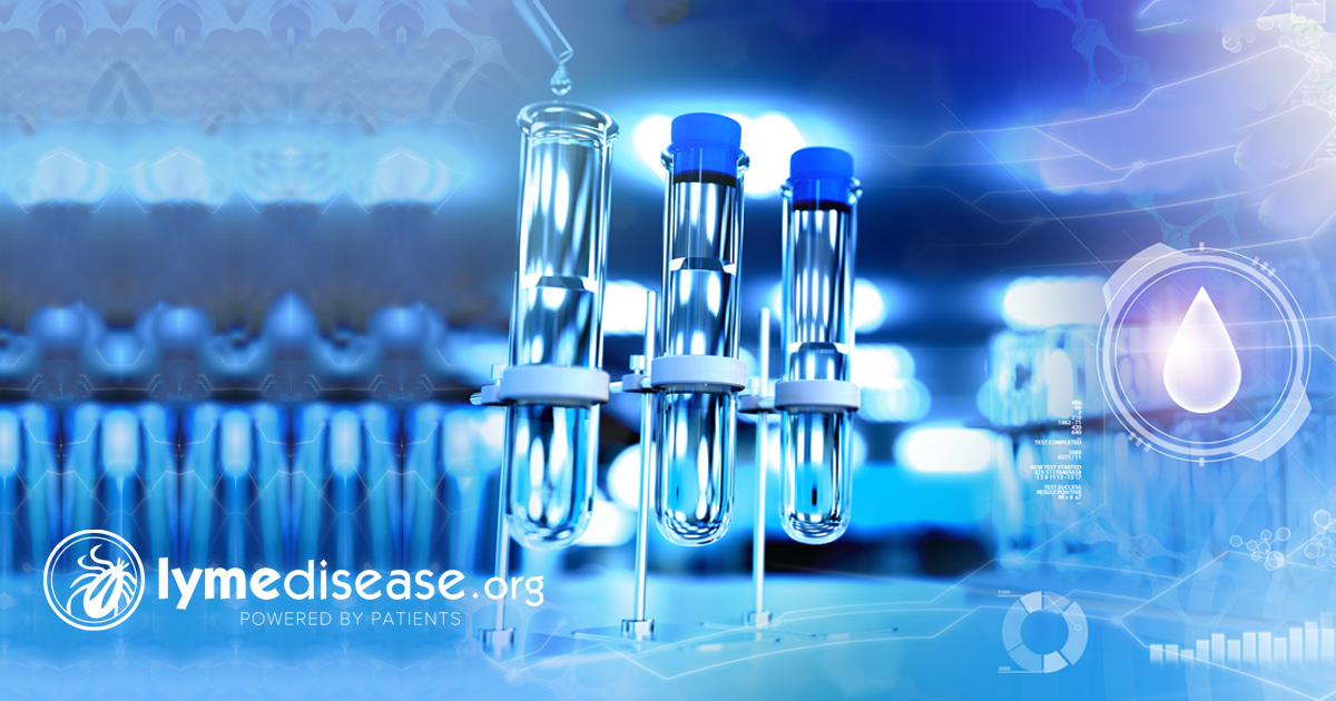 An Overview of Lyme Disease Testing by Dr. Todd Maderis