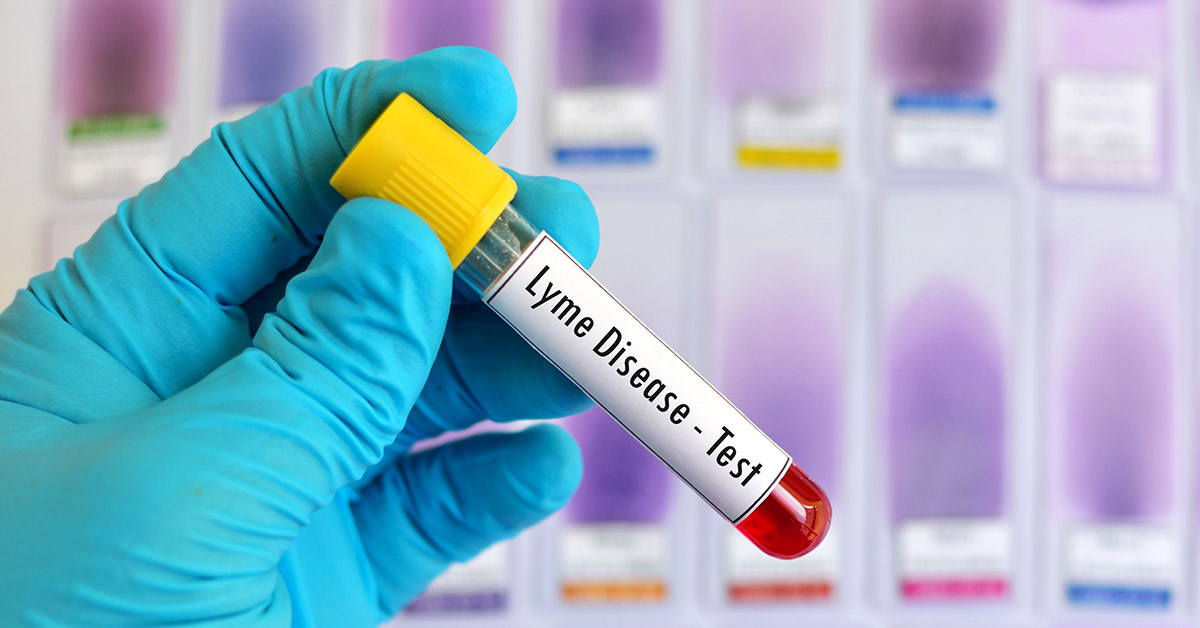 Lyme Disease Tests learn about the lyme tests available