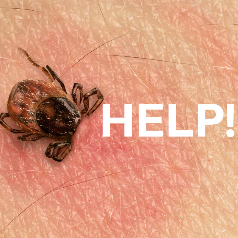 Help, I've been bitten by a tick