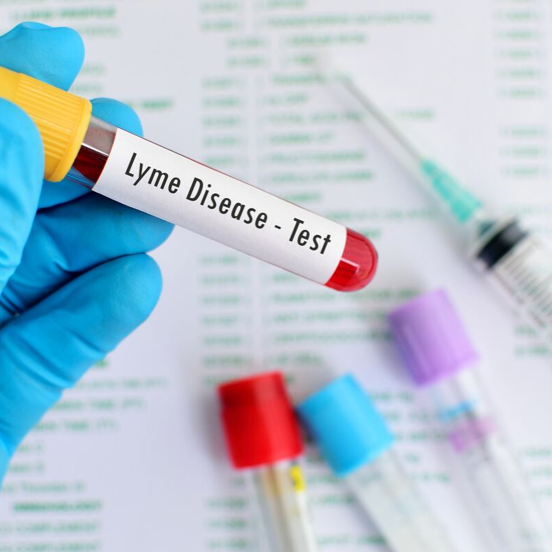 Lyme disease testing