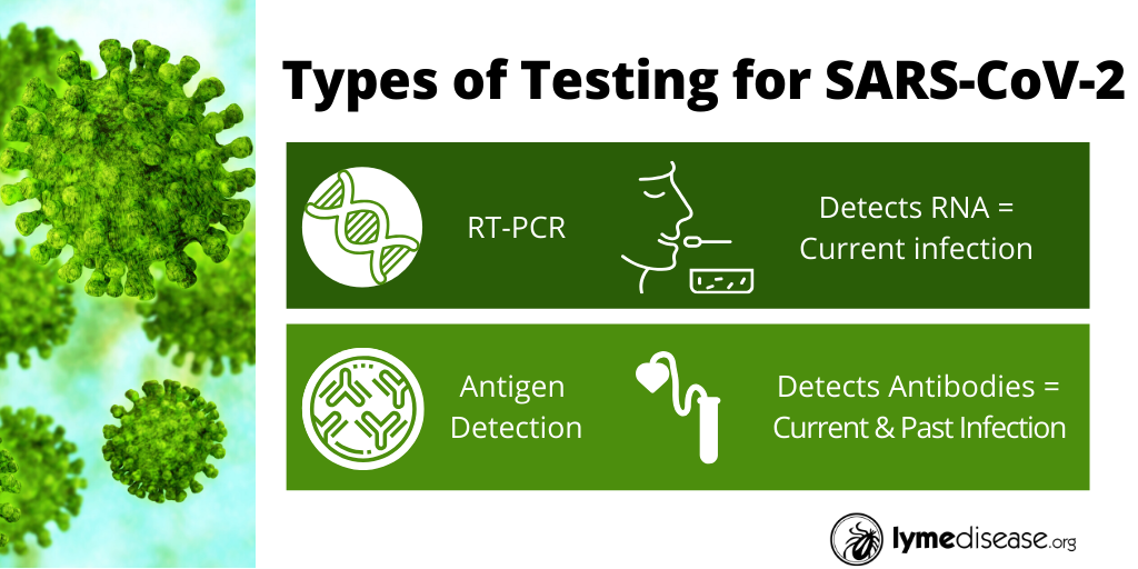 covid testing