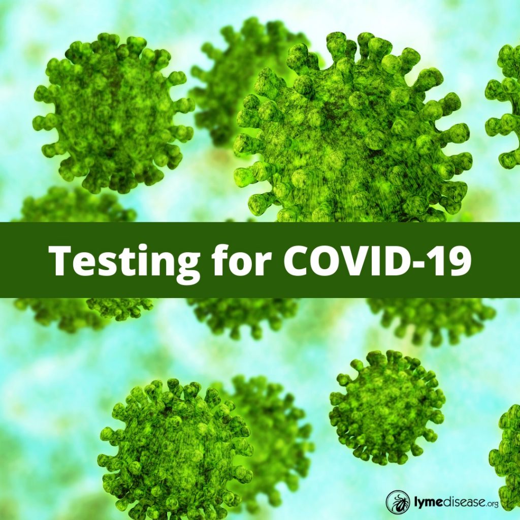 Testing for covid-19