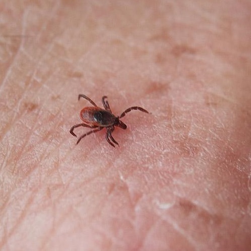 ticks most often found on thigh