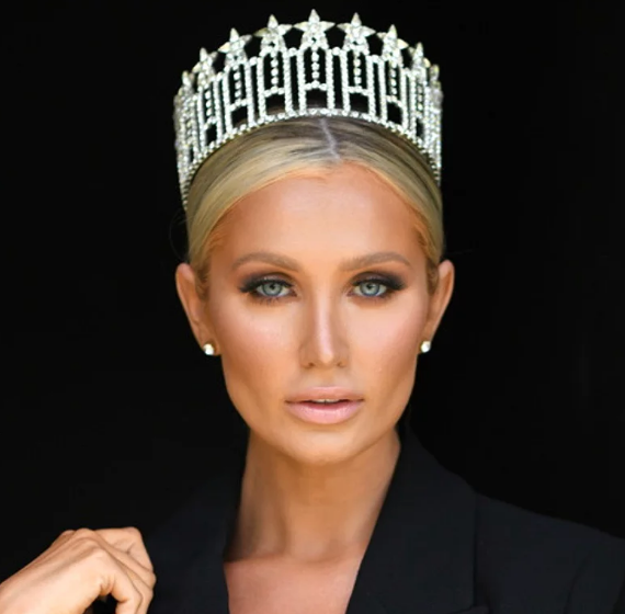 Miss California USA kept mum about Lyme disease for 24 years