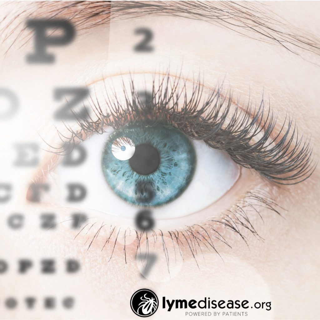 how Lyme affects eyes