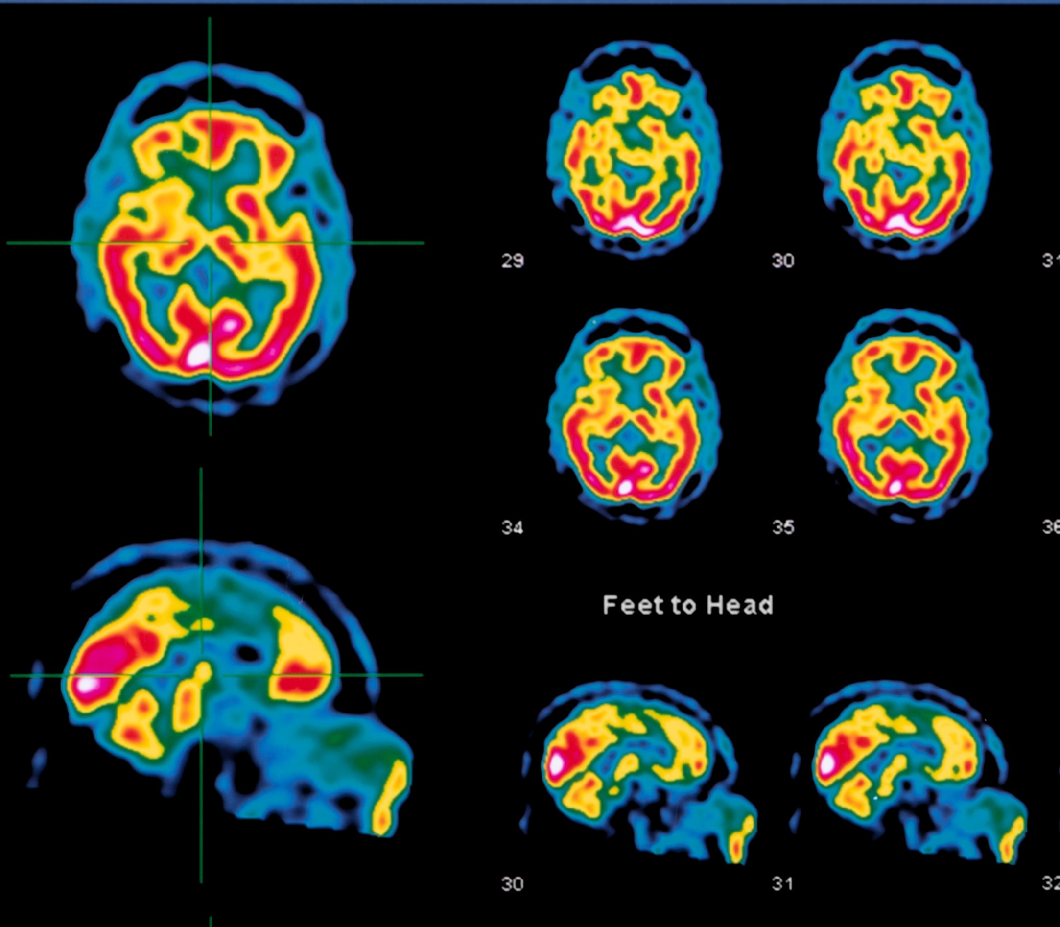 Study: What if health is really brain health?