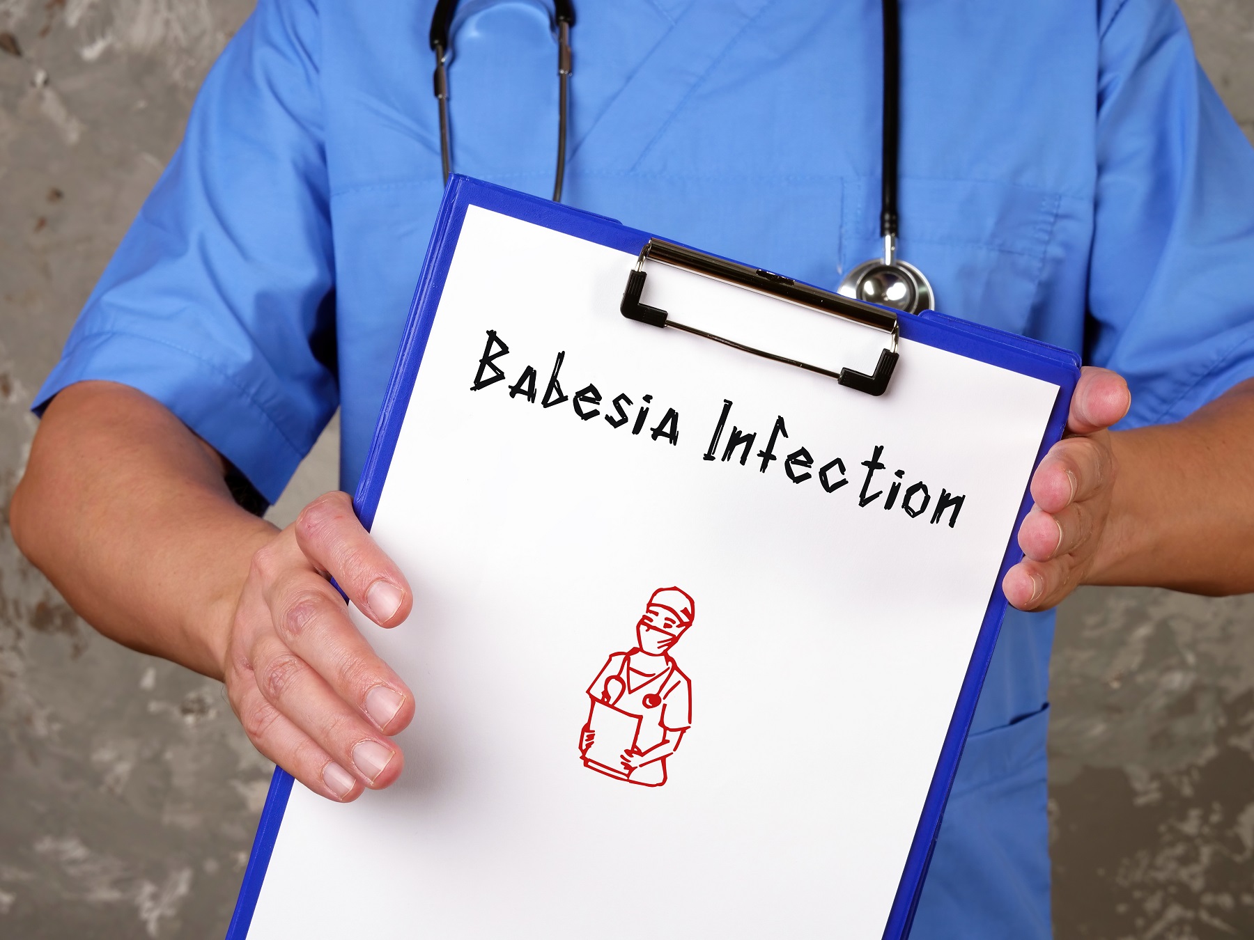 U.S. babesiosis cases may be 10x higher than CDC estimates
